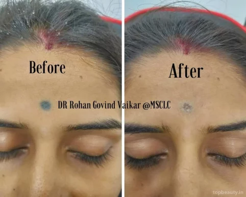 Meera Skin Clinic Dr Rohan Vaikar, Nashik - Photo 1