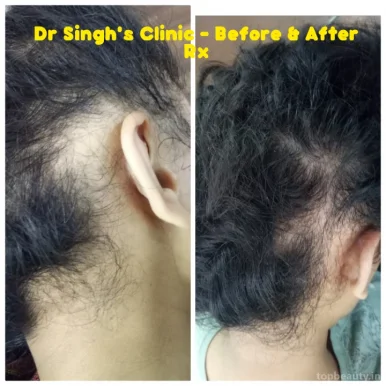 Dr Singh's - Skin Laser & Hair Transplant Centre, Nashik - Photo 5