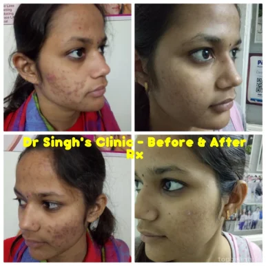 Dr Singh's - Skin Laser & Hair Transplant Centre, Nashik - Photo 6