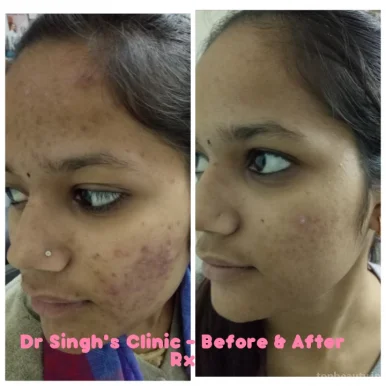 Dr Singh's - Skin Laser & Hair Transplant Centre, Nashik - Photo 3