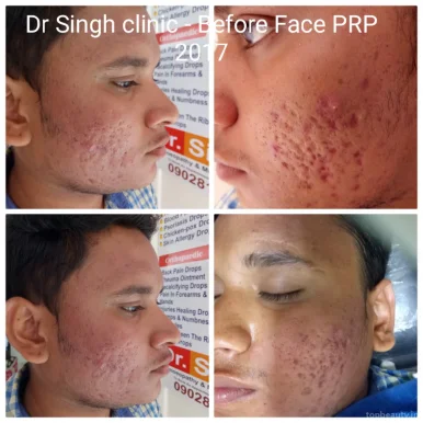 Dr Singh's - Skin Laser & Hair Transplant Centre, Nashik - Photo 4
