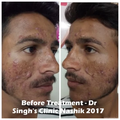 Dr Singh's - Skin Laser & Hair Transplant Centre, Nashik - Photo 7