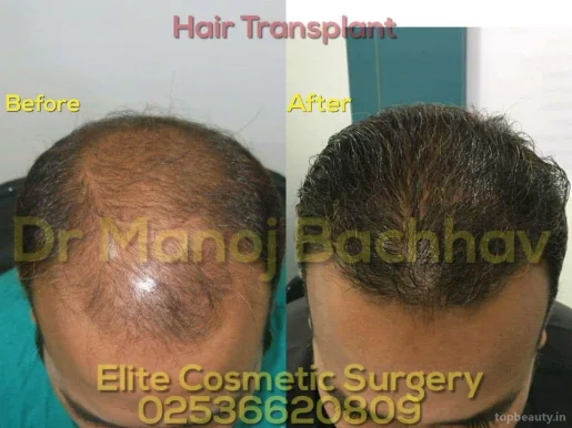 Dr Manoj Bachhav's Elite Plastic & Cosmetic Surgery, LASER & Hair Transplant Center Nashik., Nashik - Photo 1