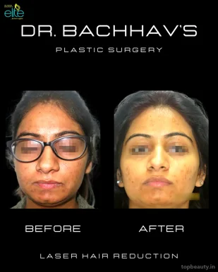 Dr Manoj Bachhav's Elite Plastic & Cosmetic Surgery, LASER & Hair Transplant Center Nashik., Nashik - Photo 7