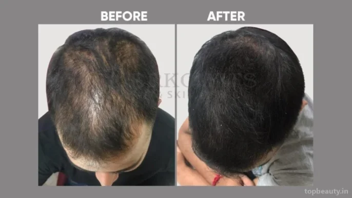 Berkowits Hair & Skin Clinic, Noida - Photo 6
