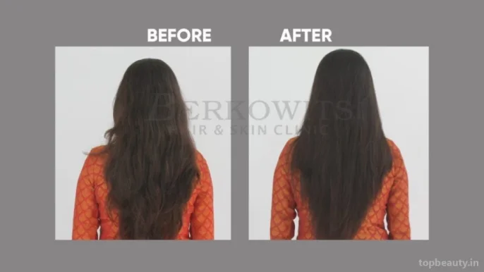 Berkowits Hair & Skin Clinic, Noida - Photo 8