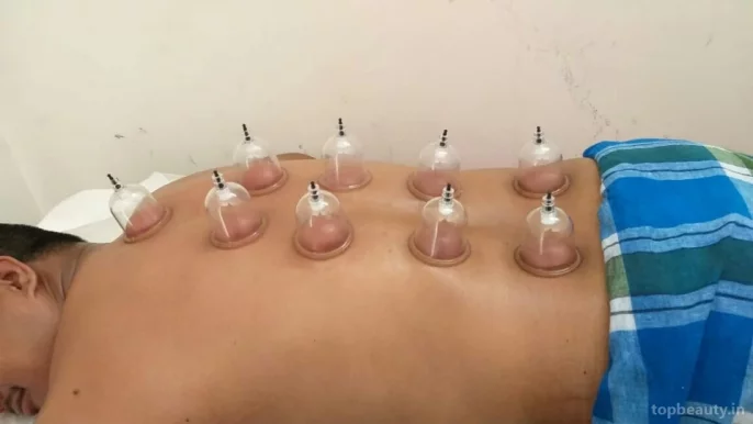 Noor Hijama Cupping Therapy Center in Pune - Hijama Cupping Treatment in Pune, Pune - Photo 2
