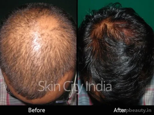 Skin City India - Skin Care and Hair Fall Treatment Specialist, Solapur - Photo 1