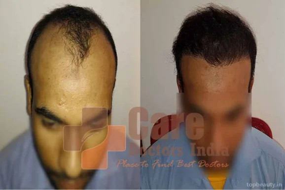 Advance Hair Transplant Clinic, Thiruvananthapuram - Photo 5