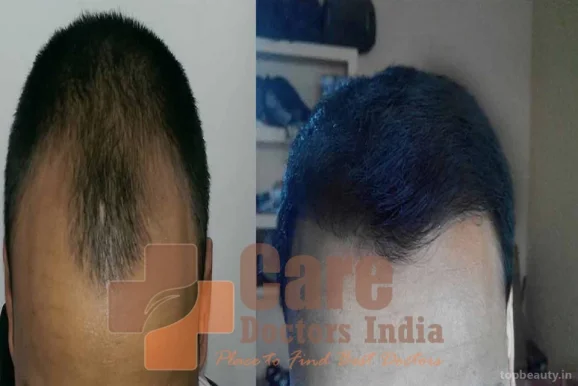 Advance Hair Transplant Clinic, Thiruvananthapuram - Photo 6