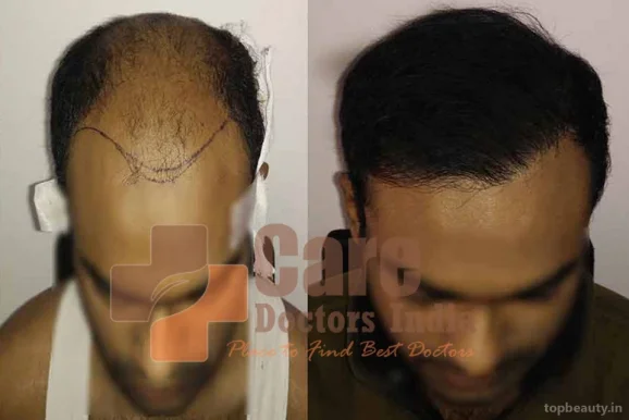 Advance Hair Transplant Clinic, Thiruvananthapuram - Photo 3