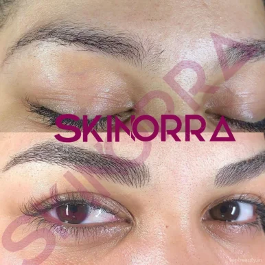 Skinorra - HydraFacial, Skin, Chemical peels, pmu permanent makeup, Vadodara - Photo 1