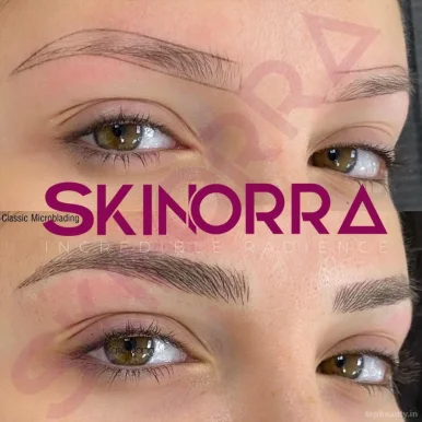 Skinorra - HydraFacial, Skin, Chemical peels, pmu permanent makeup, Vadodara - Photo 3