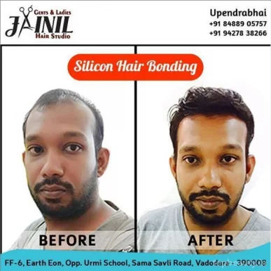 Jainil Hair Studio | Hair Bonding Glue | Hair Wig | Hair Weaving | Replacement | Grafting | Patch in Vadodara, Vadodara - Photo 4