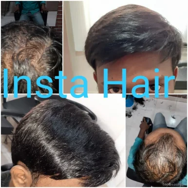 Insta Hair, Vijayawada - Photo 9