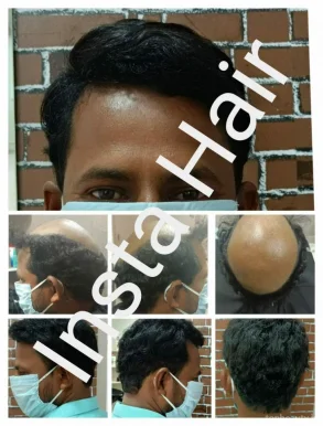 Insta Hair, Vijayawada - Photo 2