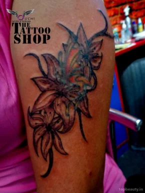 RESTORE (Tattoo Removal Service), Visakhapatnam - Photo 7